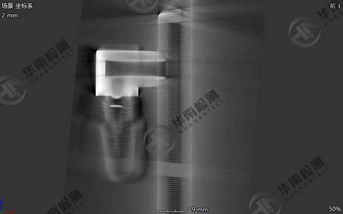 金属伪影 金属伪影